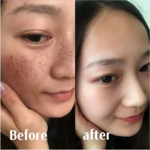 Powerful Spot-Removing Whiten Cream Vitamin C Face Cream Faical Moisturizing Nourishing Hydrating Firming Spot Facial Creams